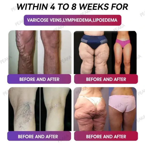 𝑂𝑓𝑓𝑖𝑐𝑖𝑎𝑙 𝑆𝑡𝑜𝑟𝑒 | PEAKA® GLP‑1 Slimming Vitality Boost Oral Strips 👩‍⚕️🥇(Just once a week, visible changes in 7 days ✅ For obesity, cardiovascular health, diabetes, sleep apnea, joint issues, and more)