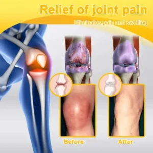 𝐀𝐄𝐄𝐇𝗙𝗘𝗡𝗚® 𝐁𝐨𝐭𝐮𝐥𝐢𝐧𝐮𝐦 𝐓𝐨𝐱𝐢𝐧 & 𝐁𝐞𝐞 𝐕𝐞𝐧𝐨𝐦 𝐒𝐨𝐨𝐭𝐡𝐢𝐧𝐠 𝐏𝐚𝐢𝐧 𝐑𝐞𝐥𝐢𝐞𝐟 𝐌𝐚𝐬𝐬𝐚𝐠𝐞 𝐆𝐞𝐥