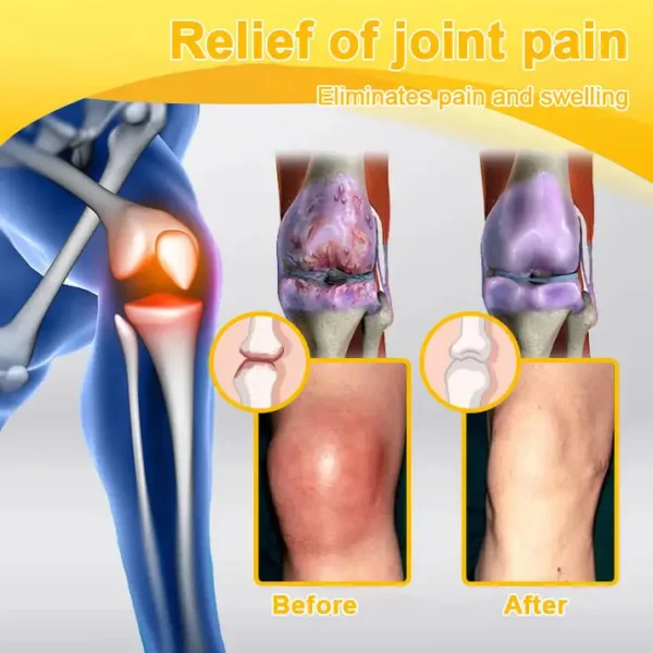 𝐀𝐄𝐄𝐇𝗙𝗘𝗡𝗚® 𝐁𝐨𝐭𝐮𝐥𝐢𝐧𝐮𝐦 𝐓𝐨𝐱𝐢𝐧 & 𝐁𝐞𝐞 𝐕𝐞𝐧𝐨𝐦 𝐒𝐨𝐨𝐭𝐡𝐢𝐧𝐠 𝐏𝐚𝐢𝐧 𝐑𝐞𝐥𝐢𝐞𝐟 𝐌𝐚𝐬𝐬𝐚𝐠𝐞 𝐆𝐞𝐥