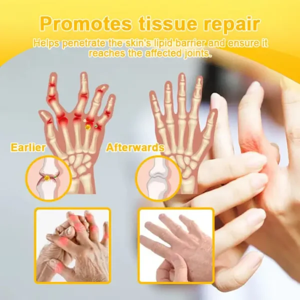 𝐀𝐄𝐄𝐇𝗙𝗘𝗡𝗚® 𝐁𝐨𝐭𝐮𝐥𝐢𝐧𝐮𝐦 𝐓𝐨𝐱𝐢𝐧 & 𝐁𝐞𝐞 𝐕𝐞𝐧𝐨𝐦 𝐒𝐨𝐨𝐭𝐡𝐢𝐧𝐠 𝐏𝐚𝐢𝐧 𝐑𝐞𝐥𝐢𝐞𝐟 𝐌𝐚𝐬𝐬𝐚𝐠𝐞 𝐆𝐞𝐥