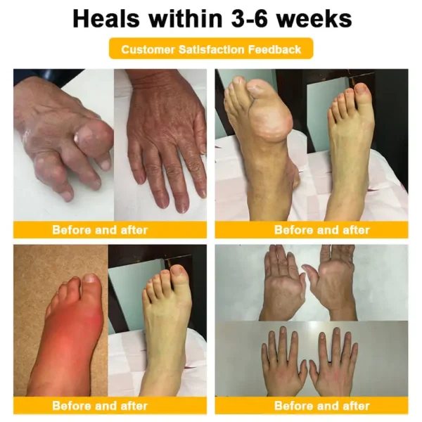 𝐀𝐄𝐄𝐇𝗙𝗘𝗡𝗚® 𝐁𝐨𝐭𝐮𝐥𝐢𝐧𝐮𝐦 𝐓𝐨𝐱𝐢𝐧 & 𝐁𝐞𝐞 𝐕𝐞𝐧𝐨𝐦 𝐒𝐨𝐨𝐭𝐡𝐢𝐧𝐠 𝐏𝐚𝐢𝐧 𝐑𝐞𝐥𝐢𝐞𝐟 𝐌𝐚𝐬𝐬𝐚𝐠𝐞 𝐆𝐞𝐥