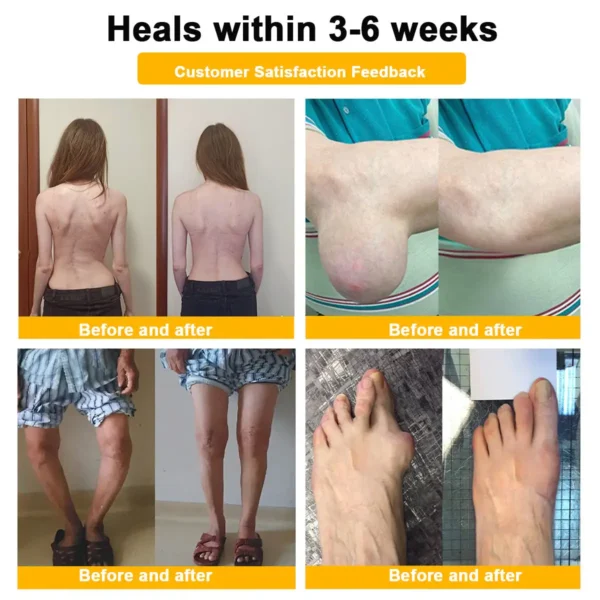 𝐀𝐄𝐄𝐇𝗙𝗘𝗡𝗚® 𝐁𝐨𝐭𝐮𝐥𝐢𝐧𝐮𝐦 𝐓𝐨𝐱𝐢𝐧 & 𝐁𝐞𝐞 𝐕𝐞𝐧𝐨𝐦 𝐒𝐨𝐨𝐭𝐡𝐢𝐧𝐠 𝐏𝐚𝐢𝐧 𝐑𝐞𝐥𝐢𝐞𝐟 𝐌𝐚𝐬𝐬𝐚𝐠𝐞 𝐆𝐞𝐥