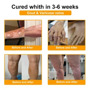 𝐀𝐄𝐄𝐇𝗙𝗘𝗡𝗚® 𝐁𝐨𝐭𝐮𝐥𝐢𝐧𝐮𝐦 𝐓𝐨𝐱𝐢𝐧 & 𝐁𝐞𝐞 𝐕𝐞𝐧𝐨𝐦 𝐒𝐨𝐨𝐭𝐡𝐢𝐧𝐠 𝐏𝐚𝐢𝐧 𝐑𝐞𝐥𝐢𝐞𝐟 𝐌𝐚𝐬𝐬𝐚𝐠𝐞 𝐆𝐞𝐥