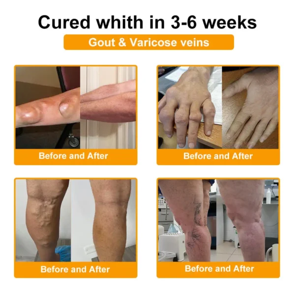 𝐀𝐄𝐄𝐇𝗙𝗘𝗡𝗚® 𝐁𝐨𝐭𝐮𝐥𝐢𝐧𝐮𝐦 𝐓𝐨𝐱𝐢𝐧 & 𝐁𝐞𝐞 𝐕𝐞𝐧𝐨𝐦 𝐒𝐨𝐨𝐭𝐡𝐢𝐧𝐠 𝐏𝐚𝐢𝐧 𝐑𝐞𝐥𝐢𝐞𝐟 𝐌𝐚𝐬𝐬𝐚𝐠𝐞 𝐆𝐞𝐥
