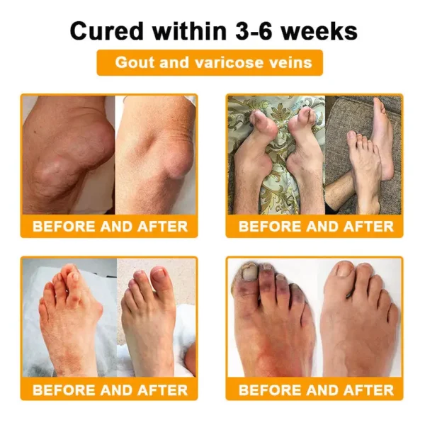 𝐀𝐄𝐄𝐇𝗙𝗘𝗡𝗚® 𝐁𝐨𝐭𝐮𝐥𝐢𝐧𝐮𝐦 𝐓𝐨𝐱𝐢𝐧 & 𝐁𝐞𝐞 𝐕𝐞𝐧𝐨𝐦 𝐒𝐨𝐨𝐭𝐡𝐢𝐧𝐠 𝐏𝐚𝐢𝐧 𝐑𝐞𝐥𝐢𝐞𝐟 𝐌𝐚𝐬𝐬𝐚𝐠𝐞 𝐆𝐞𝐥