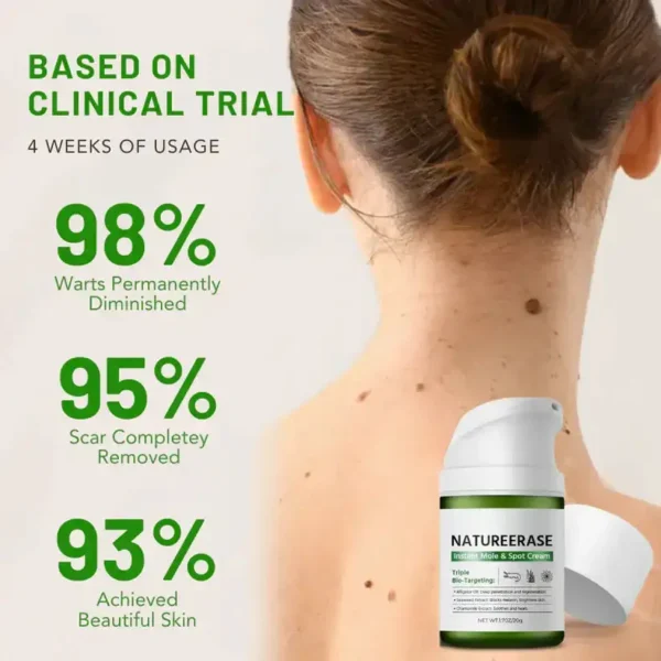 ✅ Official Store: Femica™ NatureErase Instant Mole & Spot Cream