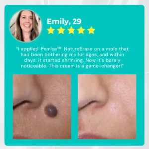 ✅ Official Store: Femica™ NatureErase Instant Mole & Spot Cream