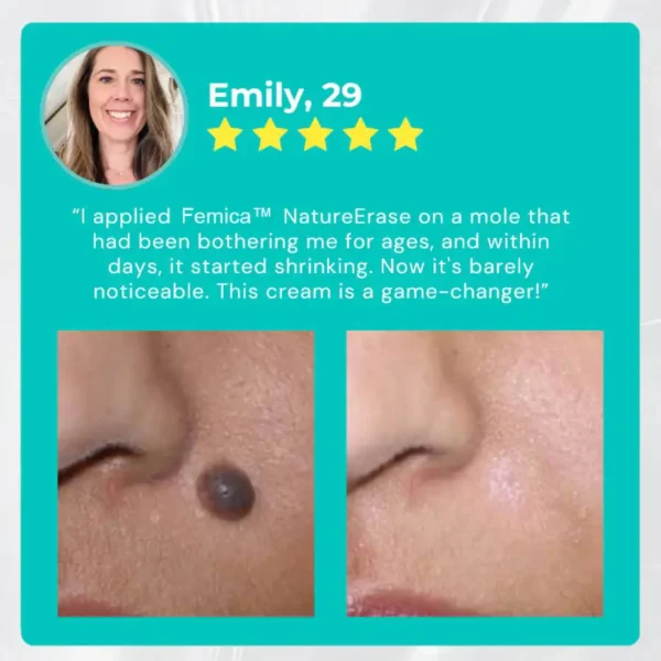 ✅ Official Store: Femica™ NatureErase Instant Mole & Spot Cream
