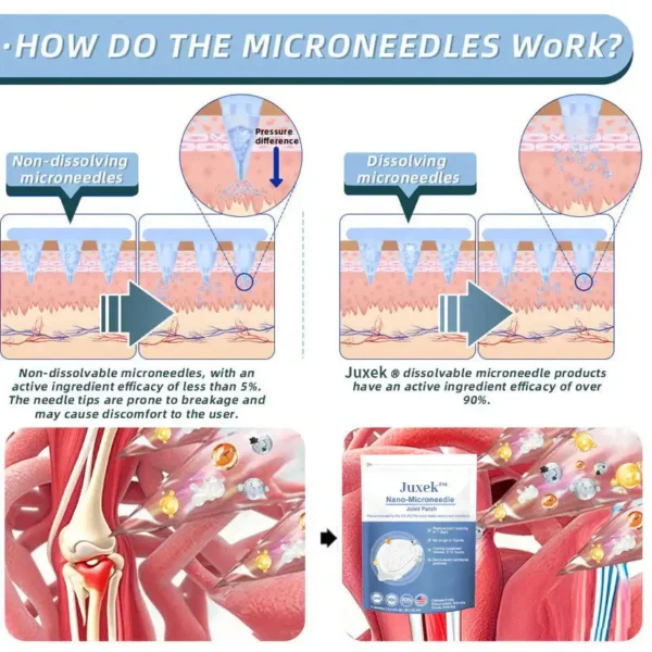 ✅ official store💎Grunsify™ Nano👩‍⚕️(COA) Recommended microneedle joint patch (painless, long-lasting, suitable for arthritis varicose veins and various orthopedic disease）
