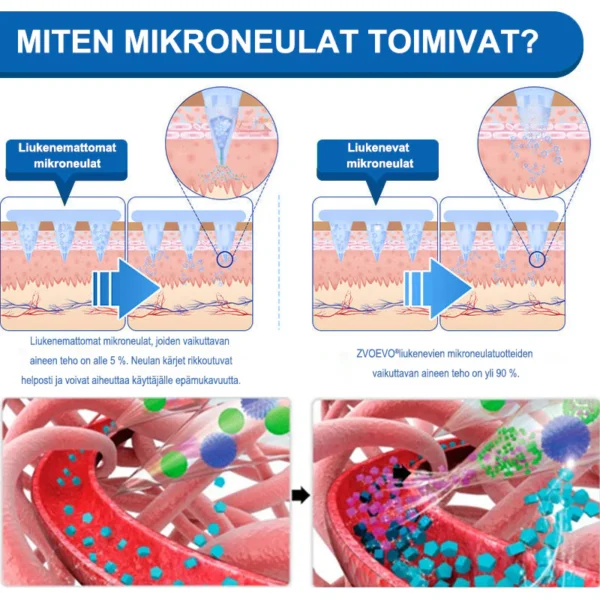 ZVOEVO® SMGT-GLP-1 𝐓𝐢𝐫𝐳𝐞𝐧𝐬𝐭𝐢 & Kollageeni Nano-Mikroneula Laihdutuslaastari
