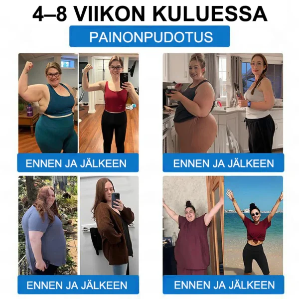 ZVOEVO® SMGT-GLP-1 𝐓𝐢𝐫𝐳𝐞𝐧𝐬𝐭𝐢 & Kollageeni Nano-Mikroneula Laihdutuslaastari
