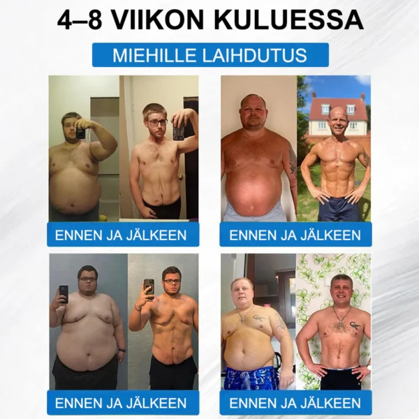 ZVOEVO® SMGT-GLP-1 𝐓𝐢𝐫𝐳𝐞𝐧𝐬𝐭𝐢 & Kollageeni Nano-Mikroneula Laihdutuslaastari
