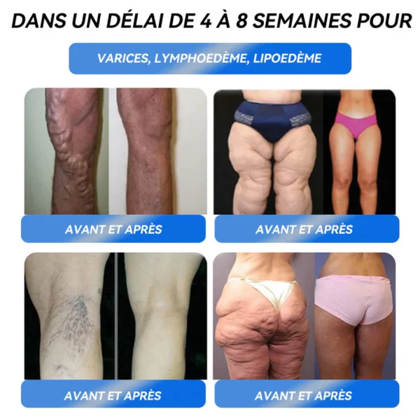 IFMAGIC® GLP-1 Pro Solution orale pour la perte de poids✅Une dose par jour—résultats visibles en 7 jours👩‍⚕️Convient à l’obésité, aux maladies cardiovasculaires, au diabète, à l’apnée du sommeil, à l’hypercholestérolémie et à divers troubles lipidiques 🌹