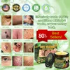Bellelala® Bee Venom Multi-Care Repair Cream