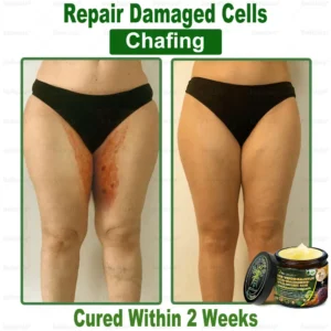 Bellelala® Bee Venom Multi-Care Repair Cream