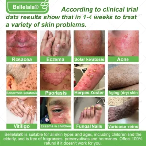 Bellelala® Bee Venom Multi-Care Repair Cream