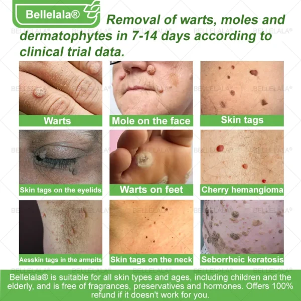 Bellelala® Bee Venom Multi-Care Repair Cream