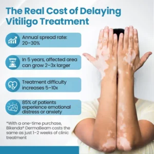 Bikenda® DermaBeam Vitiligo Therapy Device