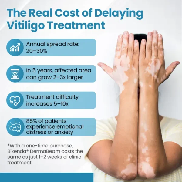 Bikenda® DermaBeam Vitiligo Therapy Device