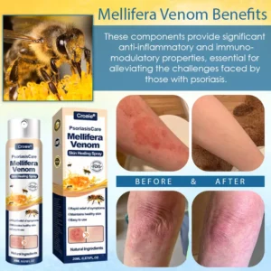 Croaie® PsoriasisCare Mellifera Venom Skin Healing Spray