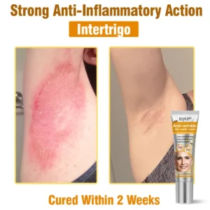 EQVP® Anti-wrinkle skin repair cream