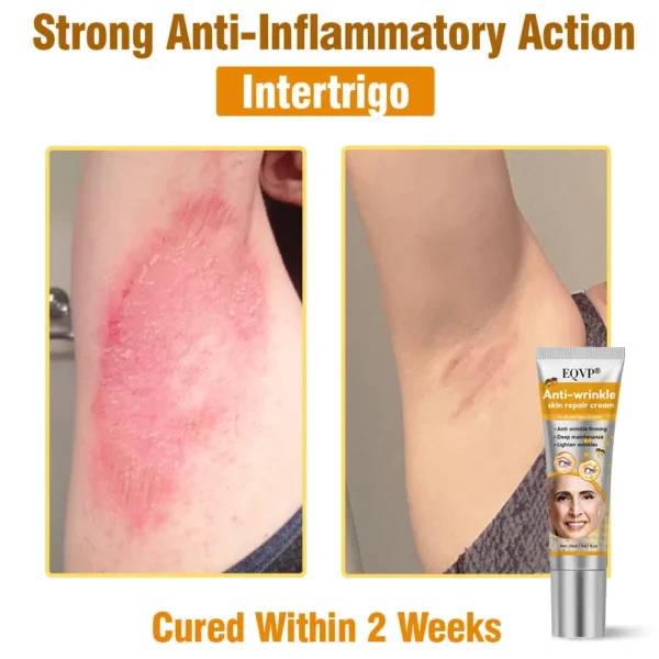 EQVP® Anti-wrinkle skin repair cream