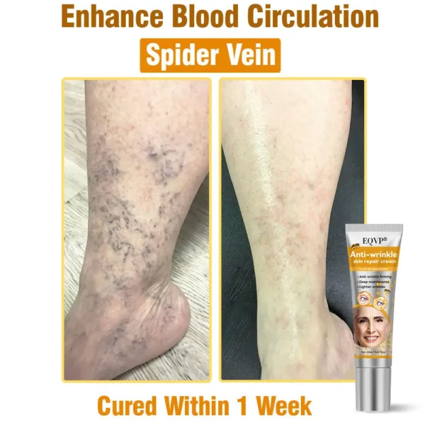 EQVP® Anti-wrinkle skin repair cream