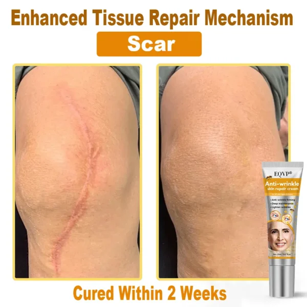 EQVP® Anti-wrinkle skin repair cream