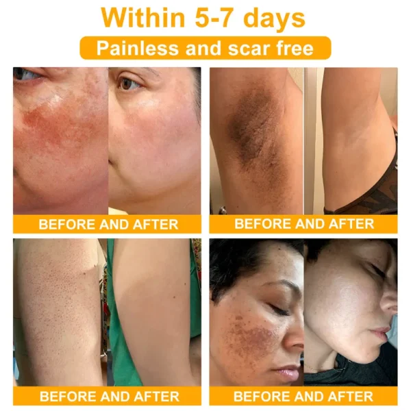EQVP® Anti-wrinkle skin repair cream