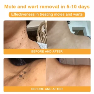 EQVP® Anti-wrinkle skin repair cream