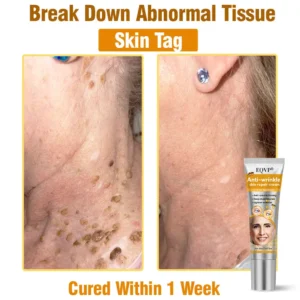 EQVP® Anti-wrinkle skin repair cream