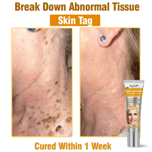EQVP® Anti-wrinkle skin repair cream