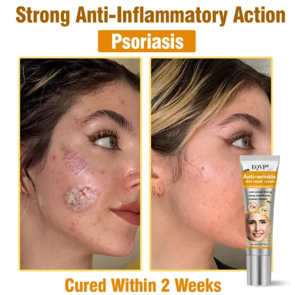 EQVP® Anti-wrinkle skin repair cream