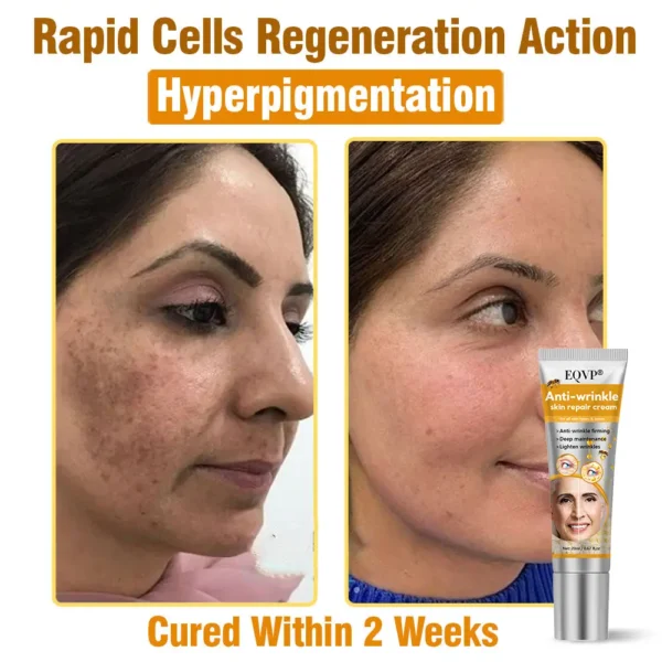 EQVP® Anti-wrinkle skin repair cream