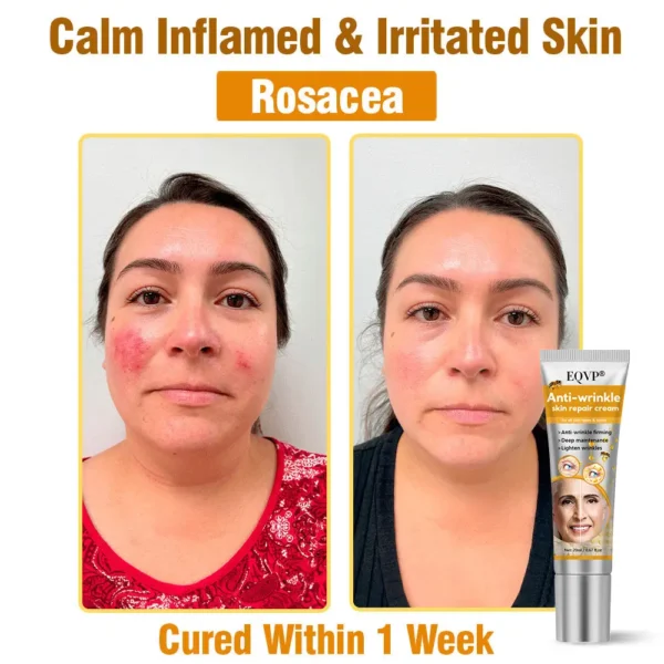 EQVP® Anti-wrinkle skin repair cream