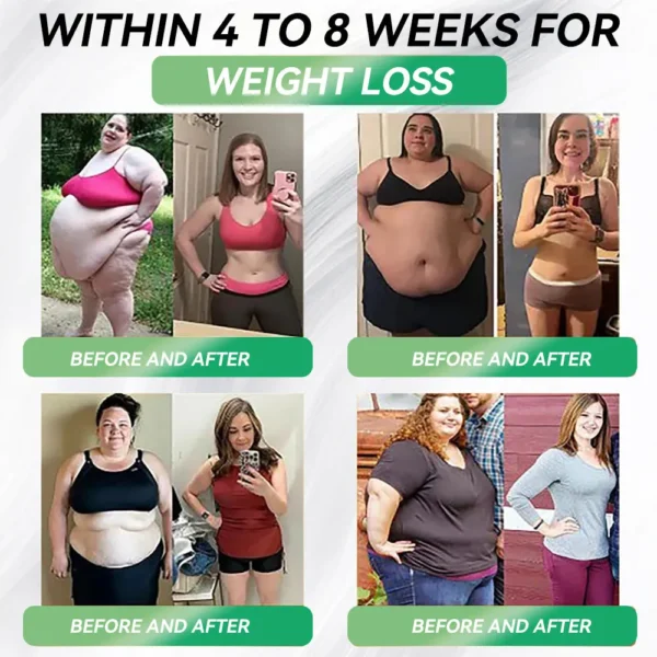 GLP-1 Weight Loss Liquid Gel🏅 - NAD+ & Moringa & ACV & Keto BHB — Obesity, Cardiovascular Disease, Diabetes, Sleep Apnea, Joint Problems and More