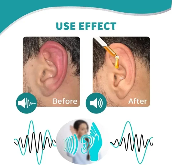 HZA ™ Ear Care Drops – Plant-Based Formula | FDA-Registered