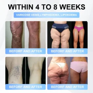 LBMLBM® Tirzepatide Slimming & Health Nano Microneedle Patch