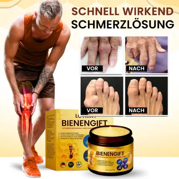 LOTMAY® Bienengift Schmerzlinderungs-Knochenheilungs-Creme