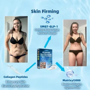 [Mayo Clinic Recommended] I Official Store | Oeskoy® SMGT-GLP-1 Nano Microneedle Slim & Firm Patch｜Slimming + Skin Tightening + Blood Sugar Support｜Regain your figure in 7 days｜No Injection Needed(Painless, Long-Lasting)