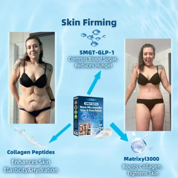 [Mayo Clinic Recommended] I Official Store | Oeskoy® SMGT-GLP-1 Nano Microneedle Slim & Firm Patch｜Slimming + Skin Tightening + Blood Sugar Support｜Regain your figure in 7 days｜No Injection Needed(Painless, Long-Lasting)