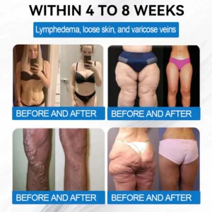 [Mayo Clinic Recommended] I Official Store | Oeskoy® SMGT-GLP-1 Nano Microneedle Slim & Firm Patch｜Slimming + Skin Tightening + Blood Sugar Support｜Regain your figure in 7 days｜No Injection Needed(Painless, Long-Lasting)