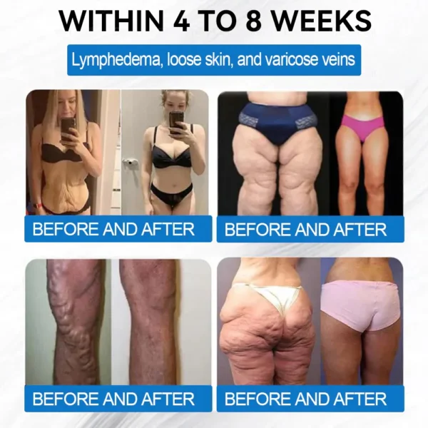 [Mayo Clinic Recommended] I Official Store | Oeskoy® SMGT-GLP-1 Nano Microneedle Slim & Firm Patch｜Slimming + Skin Tightening + Blood Sugar Support｜Regain your figure in 7 days｜No Injection Needed(Painless, Long-Lasting)