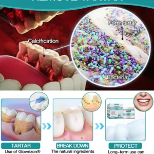 ✅Official Store |Glowrizon® Nano-Hydroxyapatite Tooth Powder 🧑🏽‍⚕️
