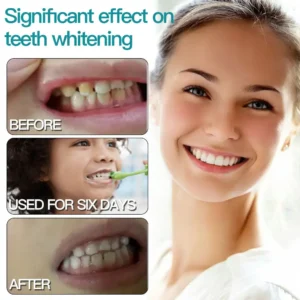 ✅Official Store |Glowrizon® Nano-Hydroxyapatite Tooth Powder 🧑🏽‍⚕️