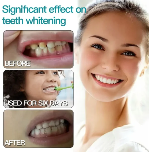✅Official Store |Glowrizon® Nano-Hydroxyapatite Tooth Powder 🧑🏽‍⚕️