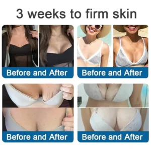 ✅Official Store: Zvoevo® Magnesium Skin Repair Cream (Smooths Wrinkles, Firms Skin and Fades Stretch Marks)
