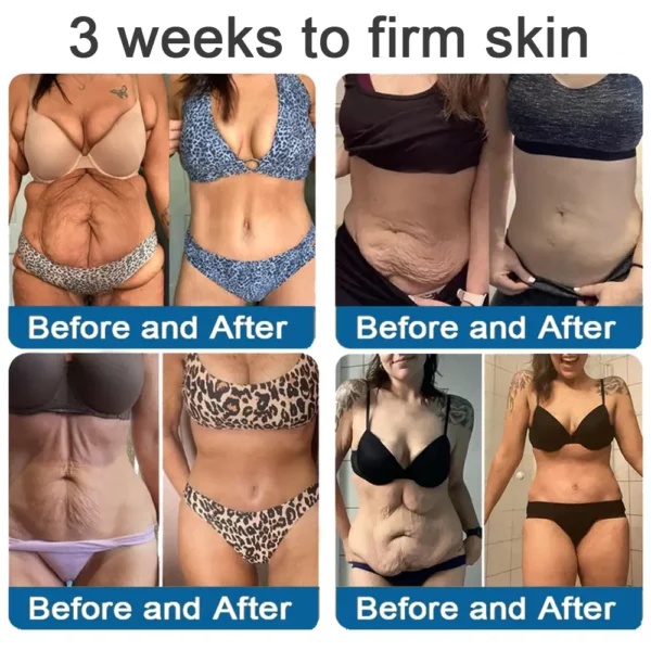 ✅Official Store: Zvoevo® Magnesium Skin Repair Cream (Smooths Wrinkles, Firms Skin and Fades Stretch Marks)