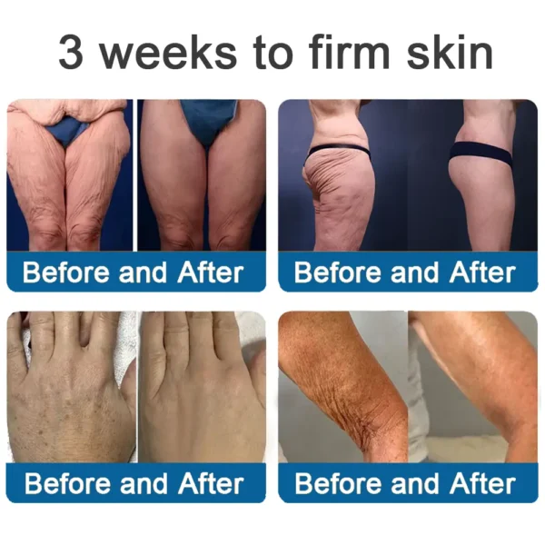 ✅Official Store: Zvoevo® Magnesium Skin Repair Cream (Smooths Wrinkles, Firms Skin and Fades Stretch Marks)