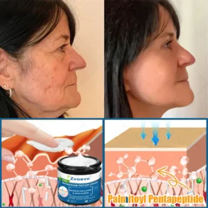 ✅Official Store: Zvoevo® Magnesium Skin Repair Cream (Smooths Wrinkles, Firms Skin and Fades Stretch Marks)
